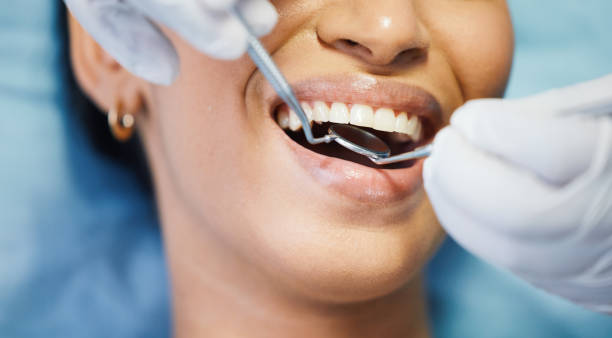 Best Urgent Tooth Repair  in Frontenac, KS