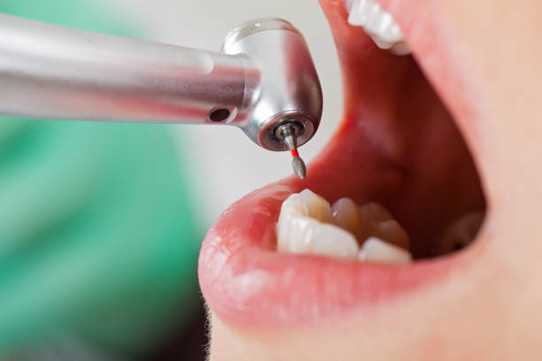 Urgent Tooth Repair in KS